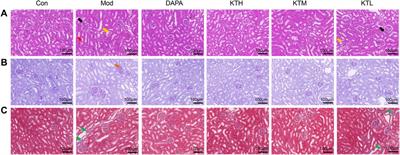 Kidney tea [Orthosiphon aristatus (Blume) Miq.] improves diabetic nephropathy via regulating gut microbiota and ferroptosis